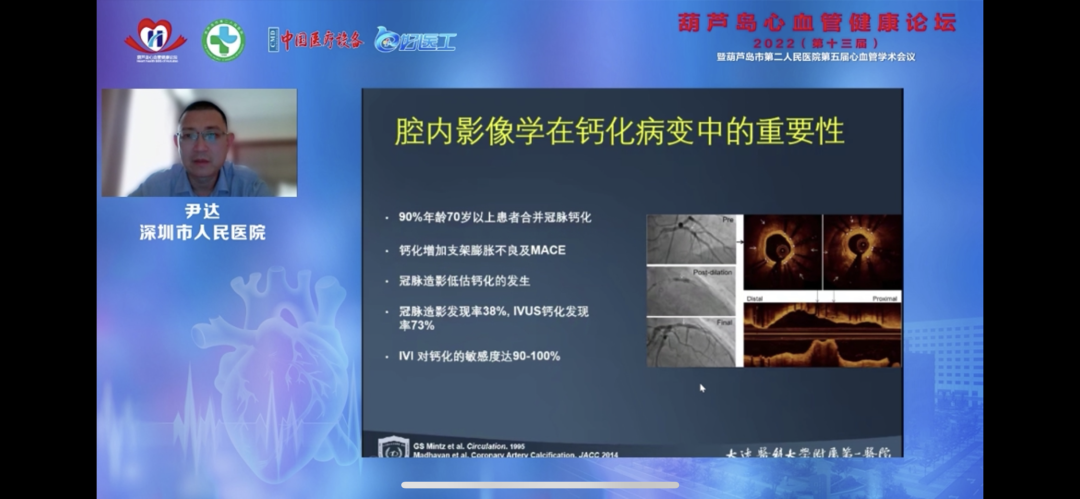 葫蘆島心血管健康論壇?2022｜創(chuàng)新驅(qū)動(dòng)發(fā)展，不斷提升心血管疾病救治能力(圖11)